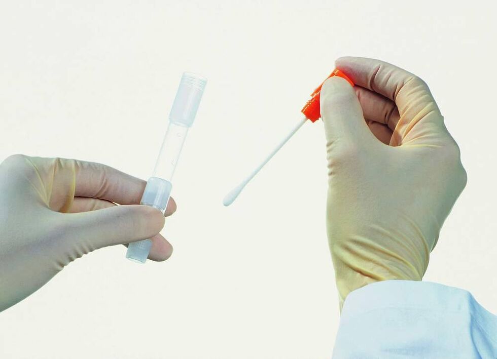 Συλλογή δοκιμών για την ανίχνευση χρόνιας προστατίτιδας